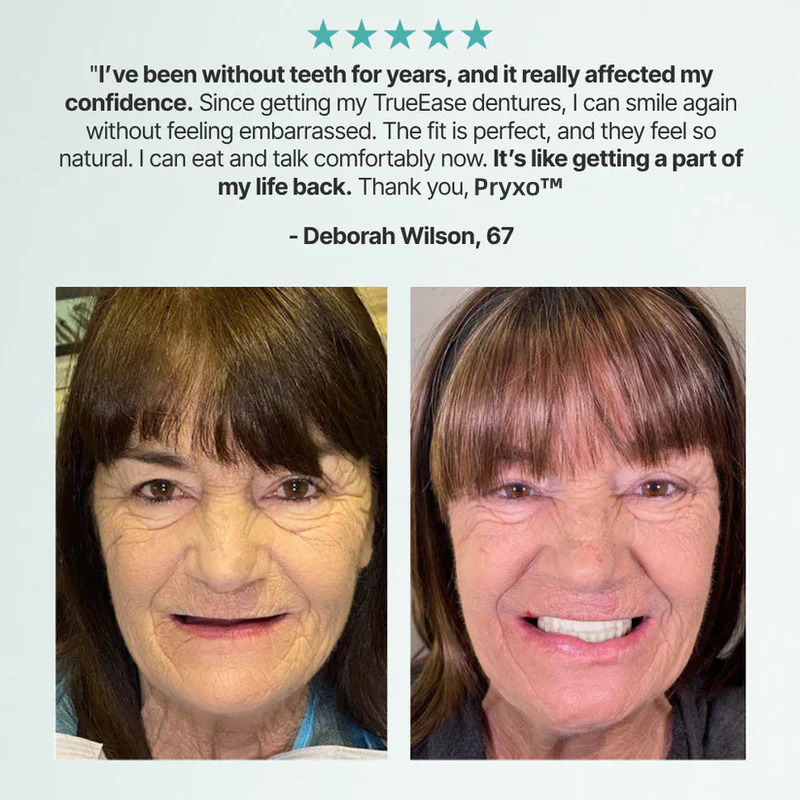 Ends Today: 70% OFF! Pryxo™? Custom-Fit Full Functional DenturesMake you more confident - Image 5